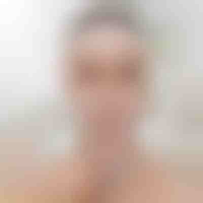 Лифтинг лента за скулптуриране на лицето | KIMLIFT